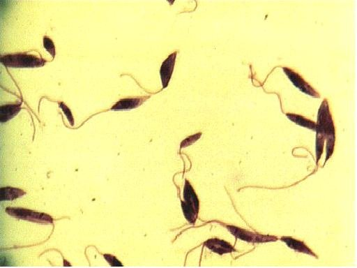 サシチョウバエに刺されることにより感染するリーシュマニア原虫の顕微鏡象