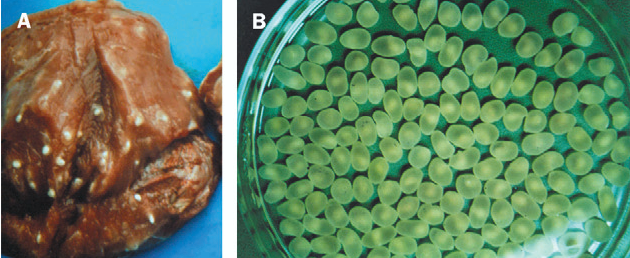 豚肉から摘出された有効条虫。嚢虫 (Cysticerci) と呼ばれる袋状の幼虫