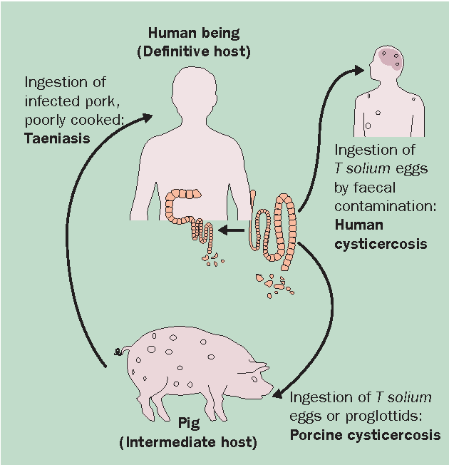 有鉤条虫 (Taenia solium) の生活環