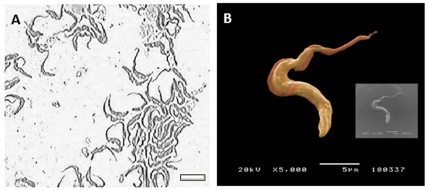 トリパノソーマ (Trypanosoma) の観察像